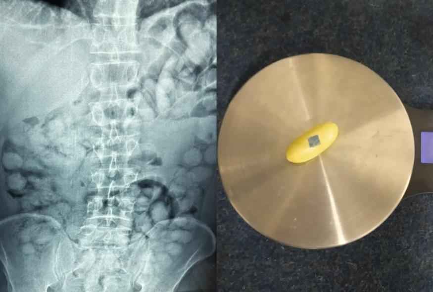 (ΓΡ. ΤΥΠΟΥ ΥΠ. ΠΡΟΣΤΑΣΙΑΣ ΤΟΥ ΠΟΛΙΤΗ / EUROKINISSI)