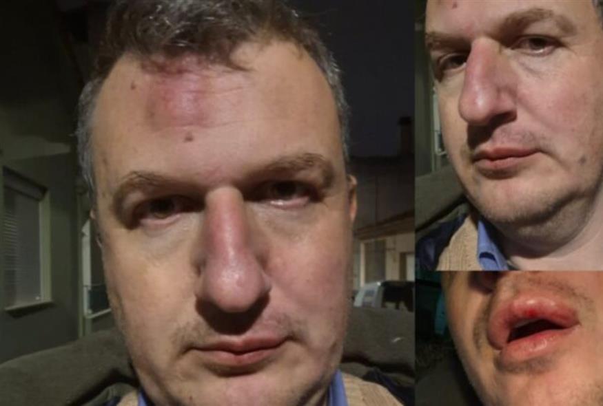 Επίθεση στον εκδότη της«Μαγνησίας» Αρχιμήδη Καρεκλίδη