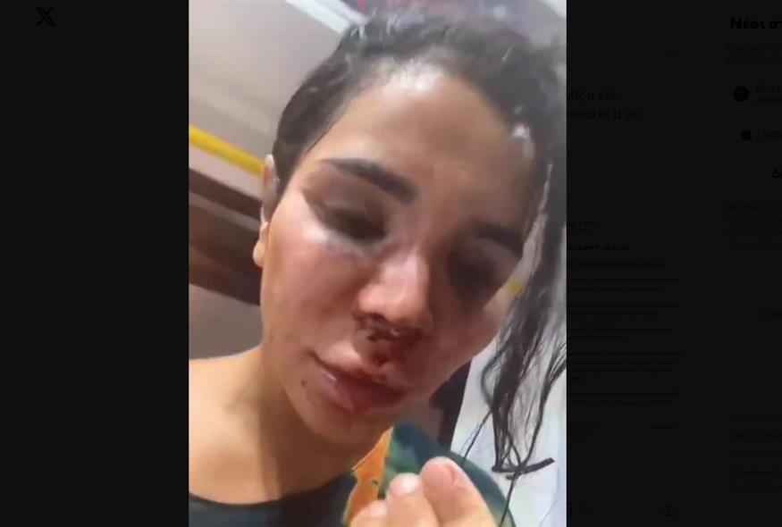 Γαλλία: Εφιαλτικές στιγμές έζησε η 30χρονη Influencer (Χ)