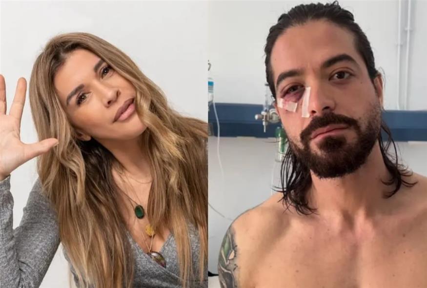 Έλληνες που ακρωτηριάστηκαν/youweekly