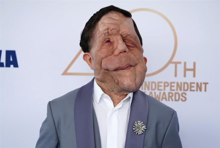 Άνταμ Πίρσον (AP)