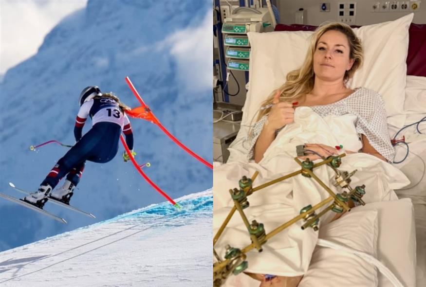 H 41χρονη πρωταθλήτρια του σκι Λίντσεϊ Βον (INSTAGRAM)