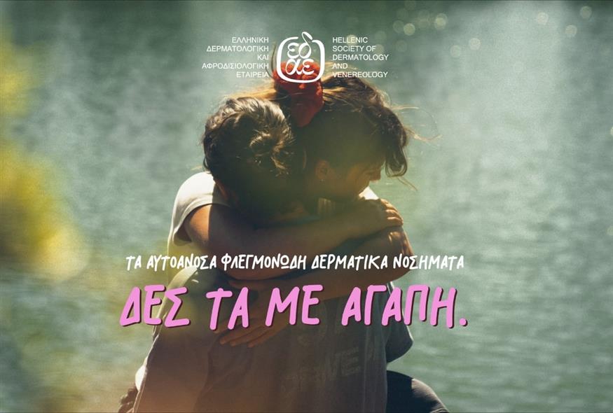 (ΕΔΑΕ)