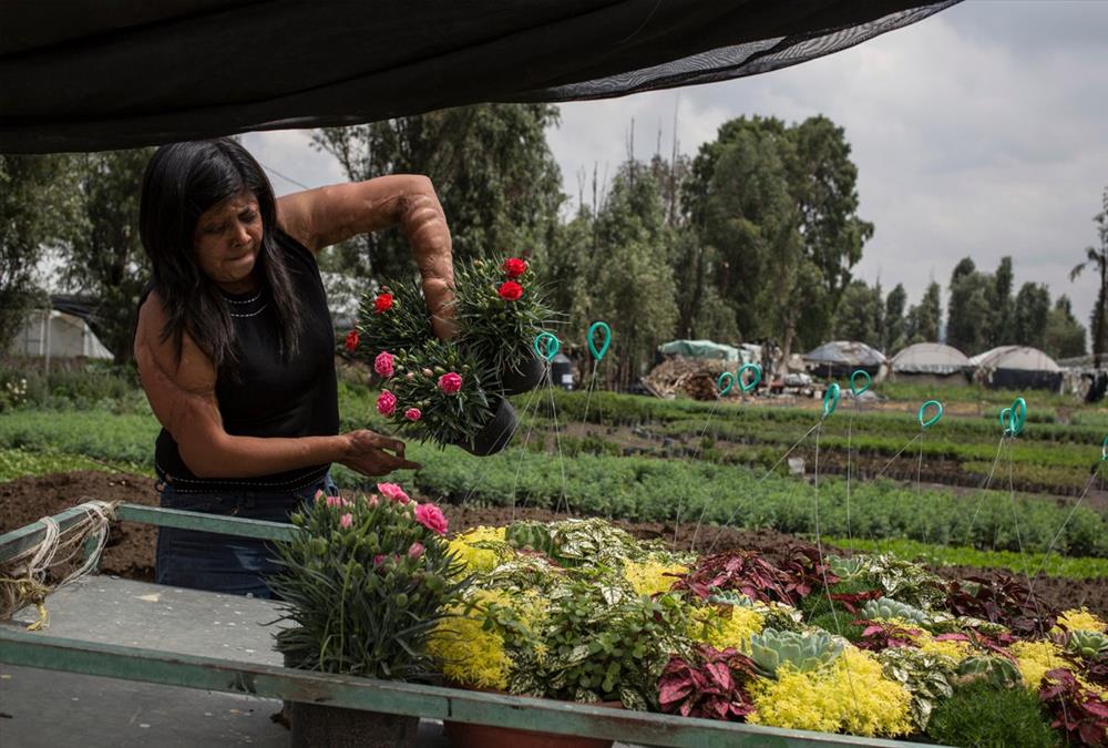 «Μπορούσα να αφήσω τον εαυτό μου να πεθάνει ή να κατανοήσω τη νέα μου πραγματικότητα» - Οι γυναίκες – θύματα επιθέσεων με οξύ συσπειρώνονται και αναζητούν δικαιοσύνη