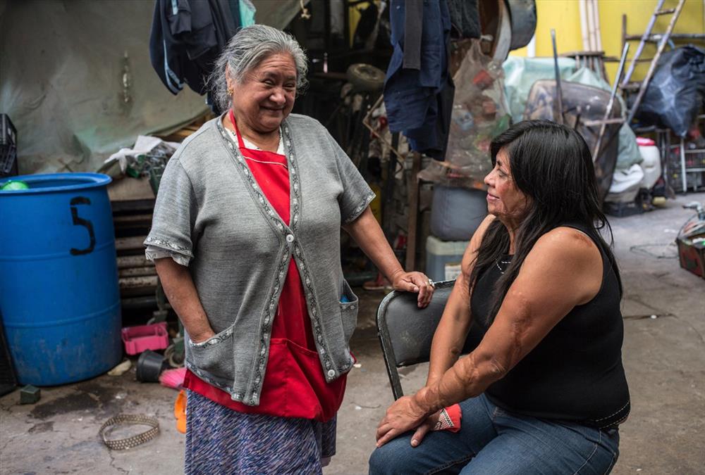 «Μπορούσα να αφήσω τον εαυτό μου να πεθάνει ή να κατανοήσω τη νέα μου πραγματικότητα» - Οι γυναίκες – θύματα επιθέσεων με οξύ συσπειρώνονται και αναζητούν δικαιοσύνη