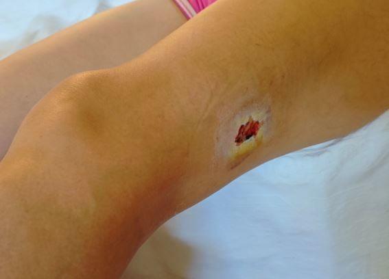 Πήλιο: Γυναίκα ούρλιαζε ζητώντας βοήθεια έπειτα από επίθεση αδέσποτων (gegonotanews.gr)