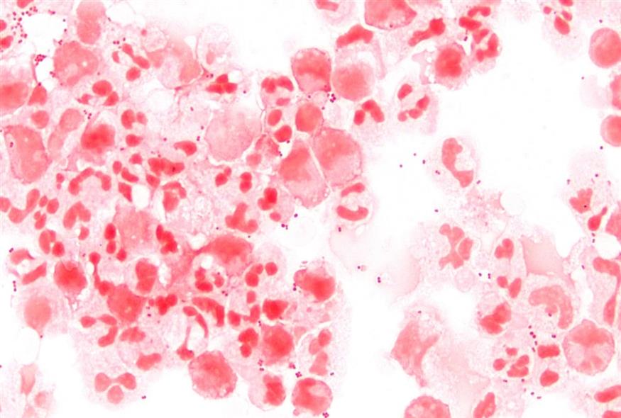 Το βακτήριο Neisseria meningitidis (By Microman12345 - Own work, CC BY-SA 4.0, https://commons.wikimedia.org/w/index.php?curid=76563138)