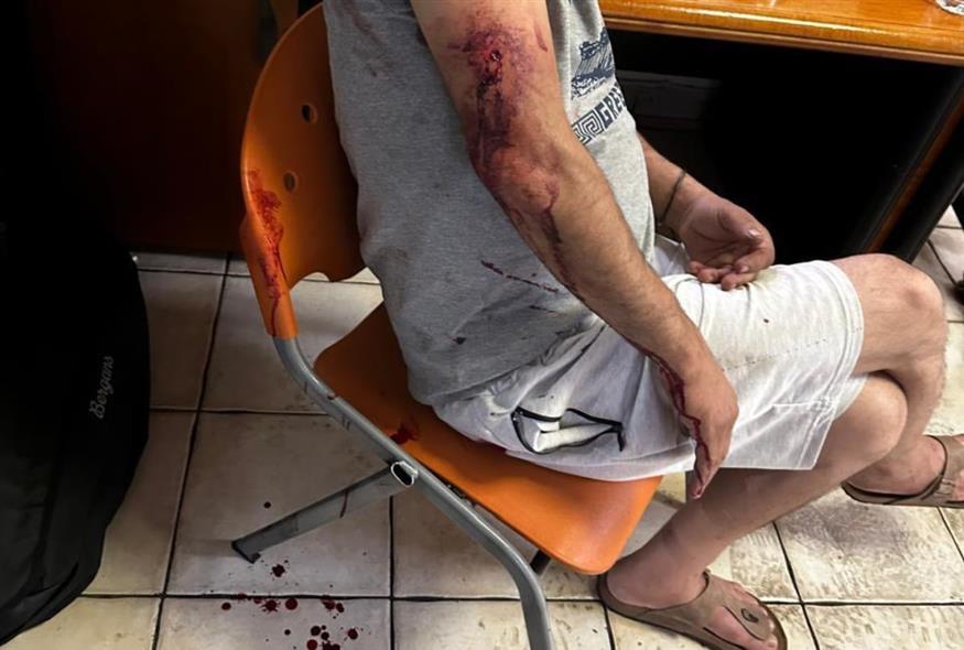 Ρατσιστική επίθεση με σιδηρολοστό κατά εργαζομένου στον Ασπρόπυργο (Facebook/ΚΕΕΡΦΑ)