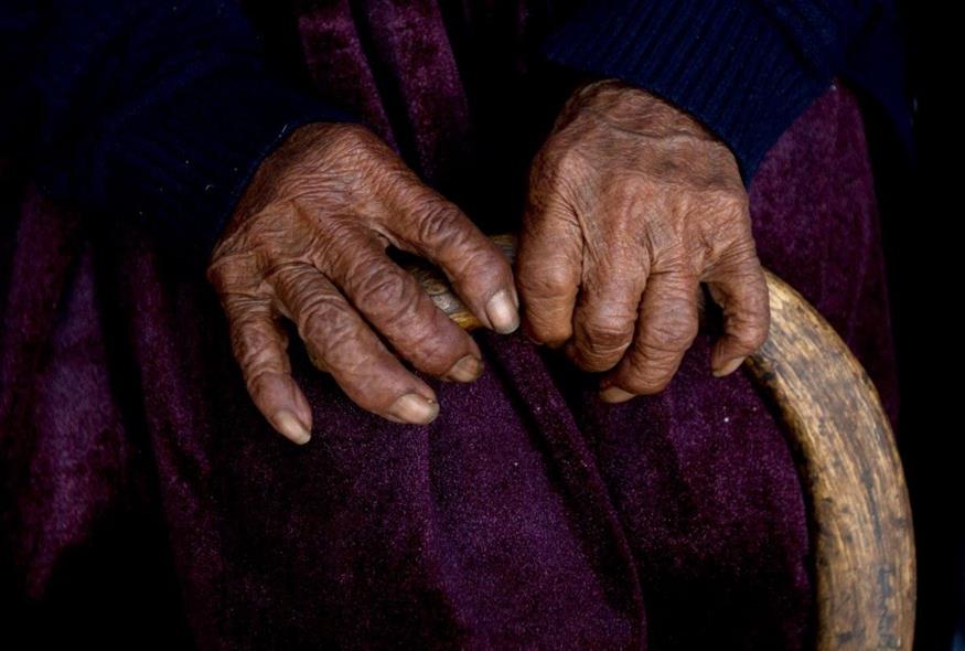 Τα χέρια γυναίκας 117 ετών (φωτογραφία αρχείου/ Associated Press)