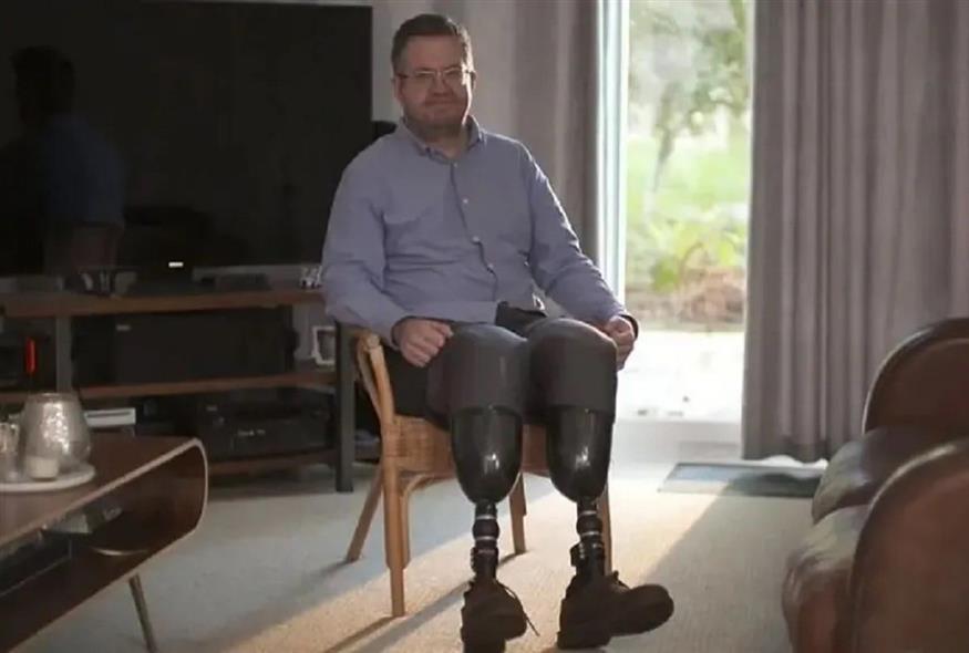 Ο 49χρονος αγγειοχειρουργός Neil Hopper ακρωτηρίασε τα πόδια του για να ικανοποιήσει σεξουαλική του φαντασίωση (Video Capture)