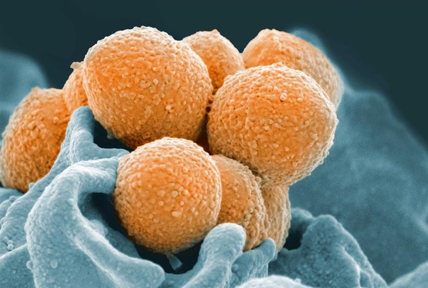 Στρεπτόκοκκος (National Institute of Allergy and Infectious Diseases via AP)