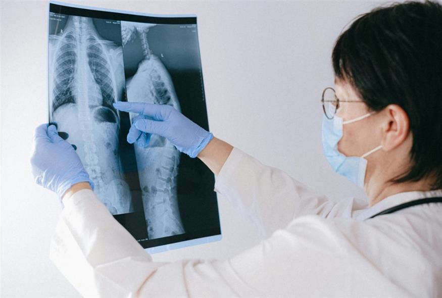 Ακτινογραφία/Pexels.com