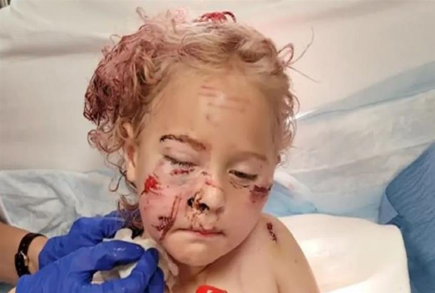 Το 5χρονο κοριτσάκι μέσα από το νοσοκομείο/ Youtube
