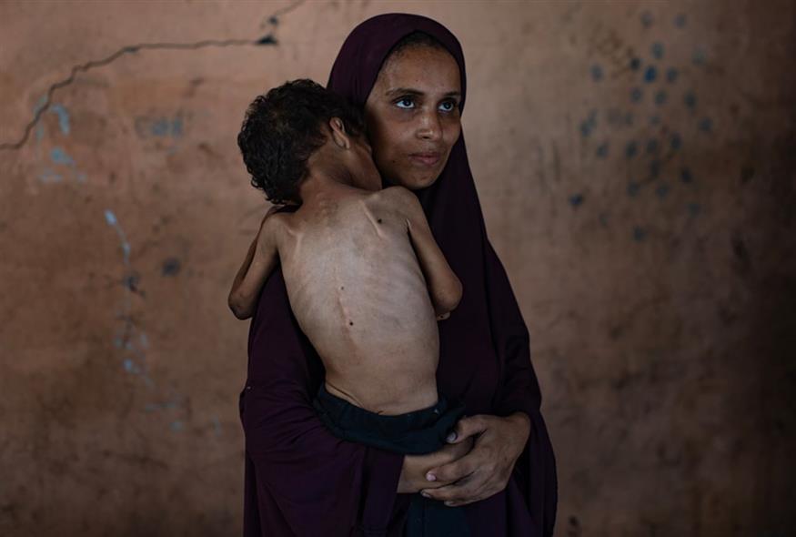 Στη Γάζα βλέπουν τα παιδιά τους να λιμοκτονούν και δεν μπορούν να τα σώσουν