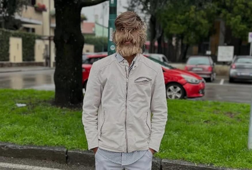 Λαλίτ Πατιντάρ/instagram