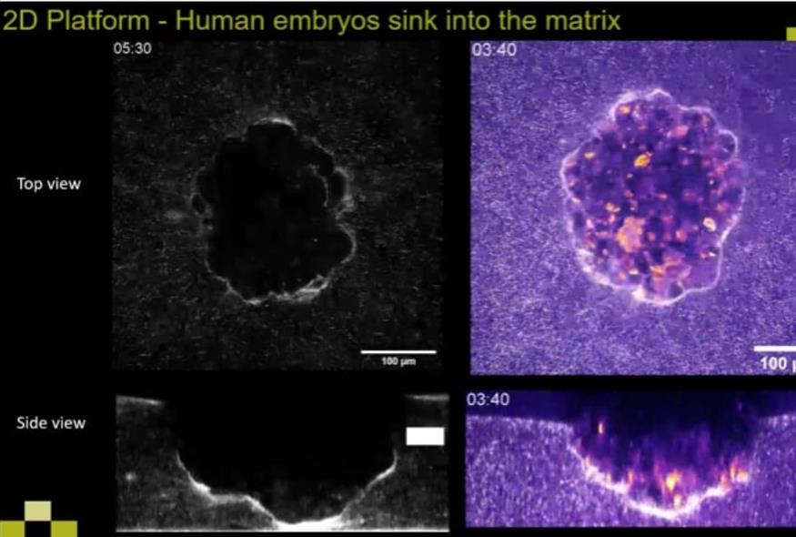 Επιστήμονες καταγράφουν για πρώτη φορά την εμφύτευση ανθρώπινου εμβρύου στη μήτρα (Guardian)