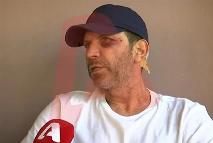 Αγρίνιο: Άγριος ξυλοδαρμός εστιάτορα από πελάτες επειδή δεν τους άρεσε το φαγητό (Youtube)