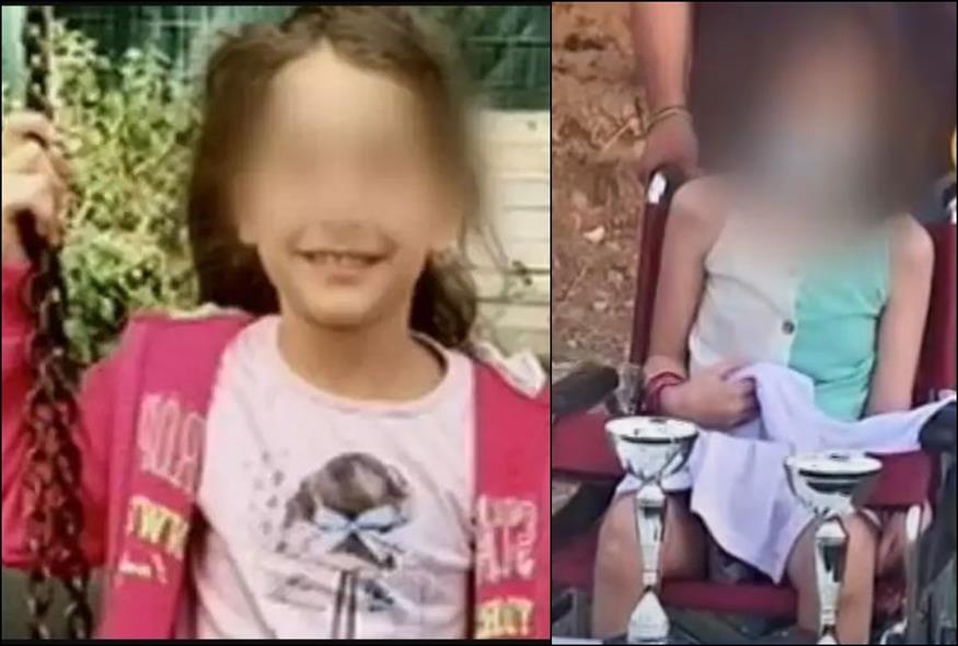 Η 8χρονη Αλεξία που τραυματίστηκε από αδέσποτη σφαίρα το Πάσχα του 2019