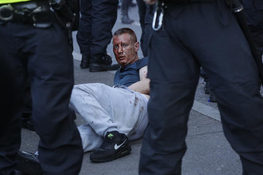 Ένας από τους τραυματίες των επεισοδίων του Σαββάτου στο Λονδίνο (AP Photo/Kirsty Wigglesworth)