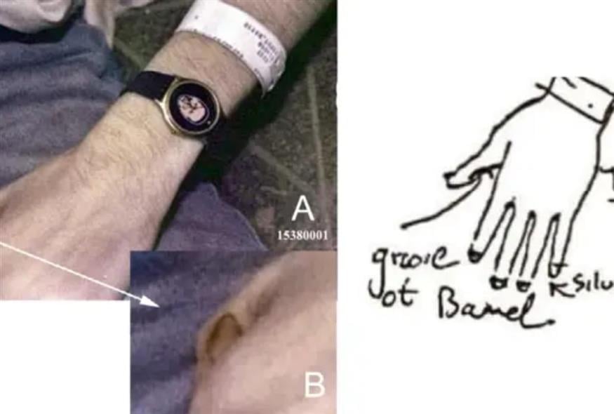 Bryan R Burnett, et al. International Journal of Forensic Sciences