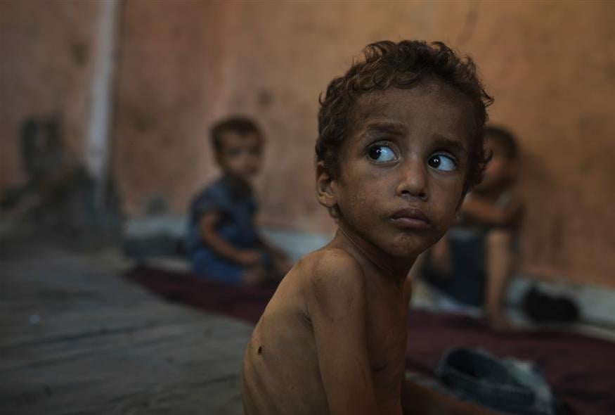 Στη Γάζα βλέπουν τα παιδιά τους να λιμοκτονούν και δεν μπορούν να τα σώσουν