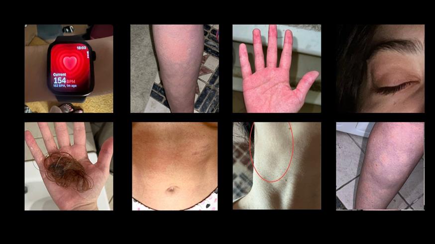 Τα συμπτώματα Τα συμπτώματα