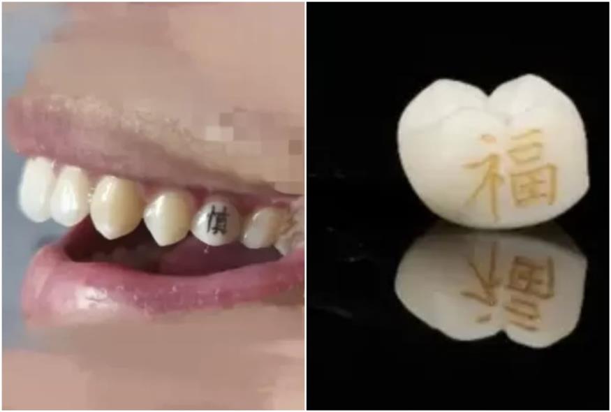 Τατουάζ στα δόντια