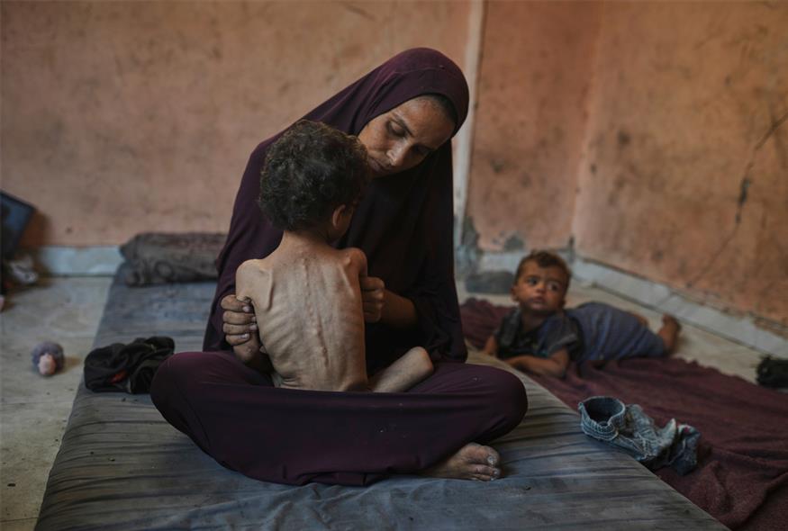 Στη Γάζα βλέπουν τα παιδιά τους να λιμοκτονούν και δεν μπορούν να τα σώσουν