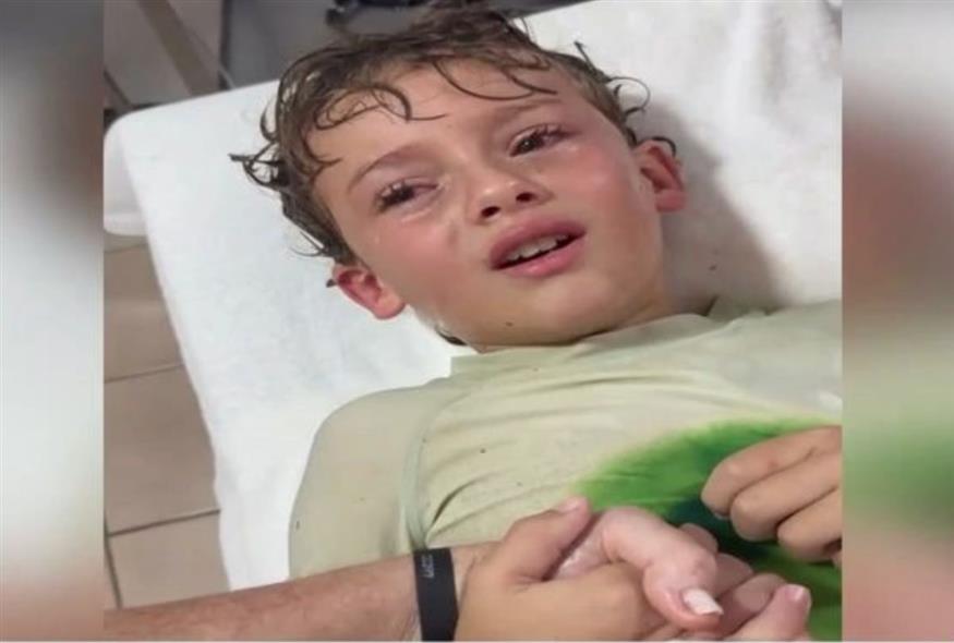 Μεξικό: Viral το μικρό αγόρι που είχε ζωντανό καβούρι στο αυτί του