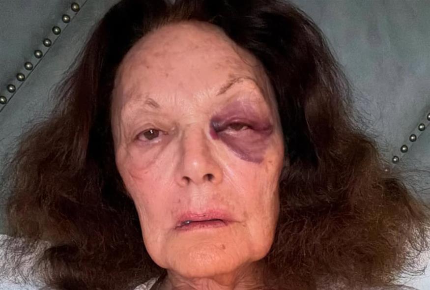 Diane Von Furstenberg (Copyright:Instagram)