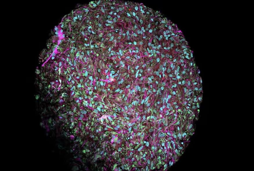 Οργανοειδές στο μικροσκόπιο. Οι νευρώνες είναι επιχρωματισμένοι. Πηγή Jesse Plotkin/Johns Hopkins University