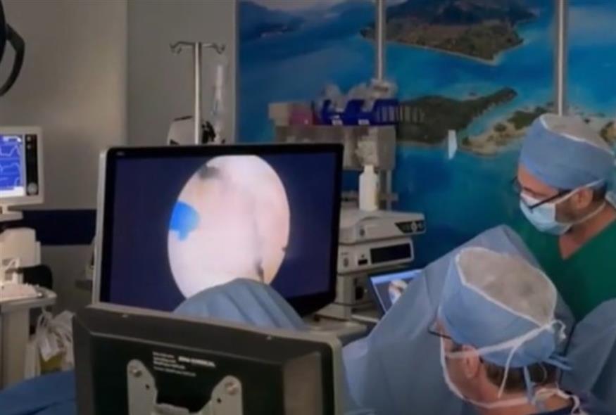 Τεχνική MiLEP