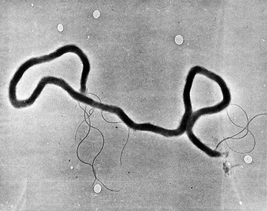 Φωτογραφία του 1944 και το βακτήριο treponema pallidum, που προκαλεί σύφιλη, φαίνεται μέσω ηλεκτρονικού μικροσκοπίου. /copyright Ap Photos
