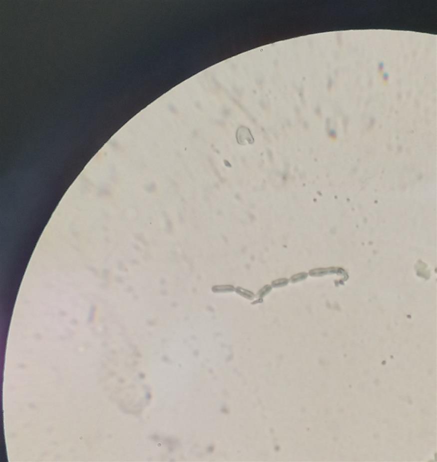 Το υπερθερμόφιλο βακτήριο του γένους Bacillus που απομονώθηκε από το υποθαλάσσιο ηφαίστειο Κολούμπο (φωτογραφία μικροσκοπίου)