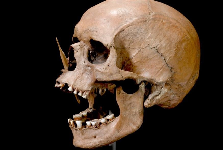 Ο άνθρωπος Porsmose που χρονολογείται τη Νεολιθική περίοδο και βρέθηκε με ένα κεφάλι βέλους στη μύτη το 1947 στην περιοχή Porsmose της Δανίας (The Danish National Museum)