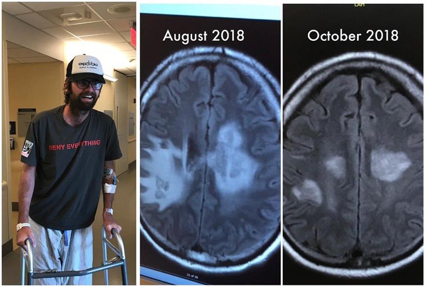Ο 35χρονος που πέρασε την απίστευτη περιπέτεια και δύο μαγνητικές τομογραφίες του εγκεφάλου του/facebook