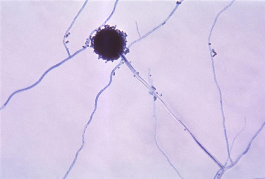 Ο μύκητας Aspergillus flavus (Βικιπαίδεια)