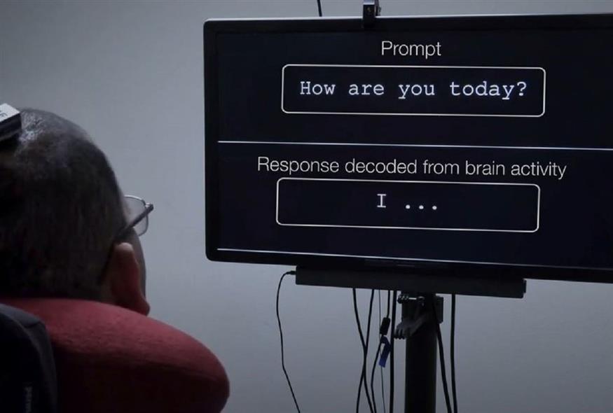 Η νευροπροσθετική συσκευή που «διαβάζει» τον εγκέφαλο και ξαναδίνει «φωνή» σε άτομα με παράλυση ομιλίας (Video Capture)