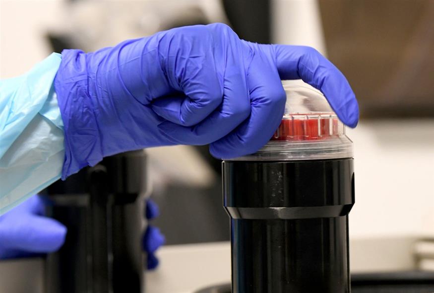 Εξέταση δείγματος αίματος στο εργαστήριο / AP Photo/Taimy Alvarez