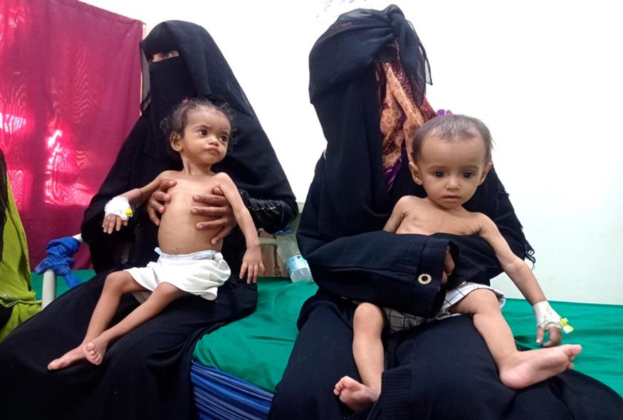 Παιδιά πεινούν στην Υεμένη/AP IMAGES