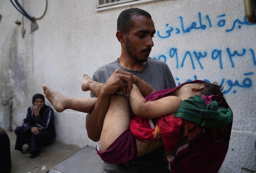 Η Γάζα σε κατάσταση λιμού και υποσιτισμού (ΑP)