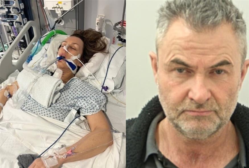 Παράλυτη έμεινε 57χρονη που της επιτέθηκε ο σύντροφός της (dailymail.co.uk)