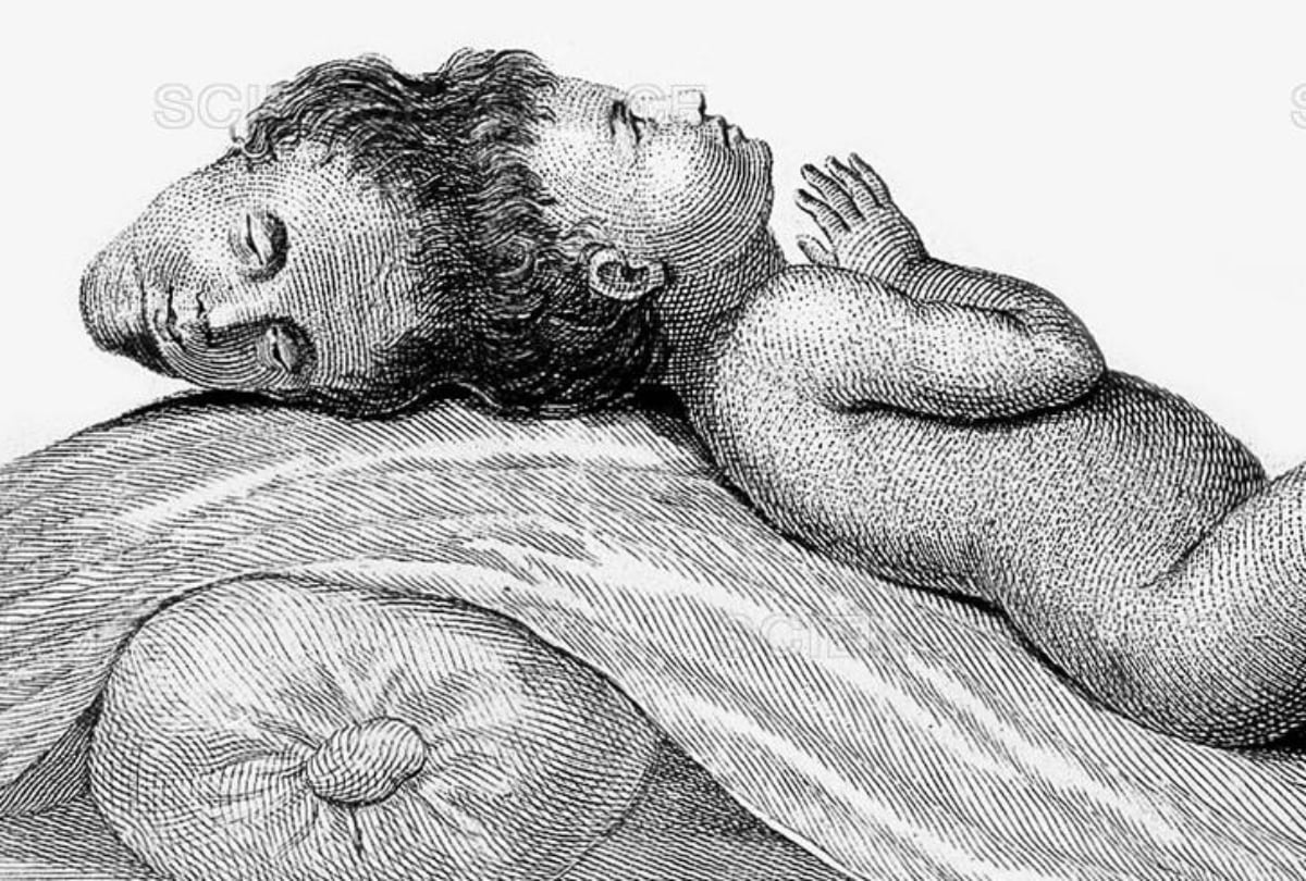 Το Δικέφαλο αγόρι της Βεγγάλης: Γεννήθηκε με δυο κεφάλια, το έκαψαν, το περιέφεραν σε εκθέσεις και στο τέλος τον σκότωσε κόμπρα. Αν έχεις τύχη
