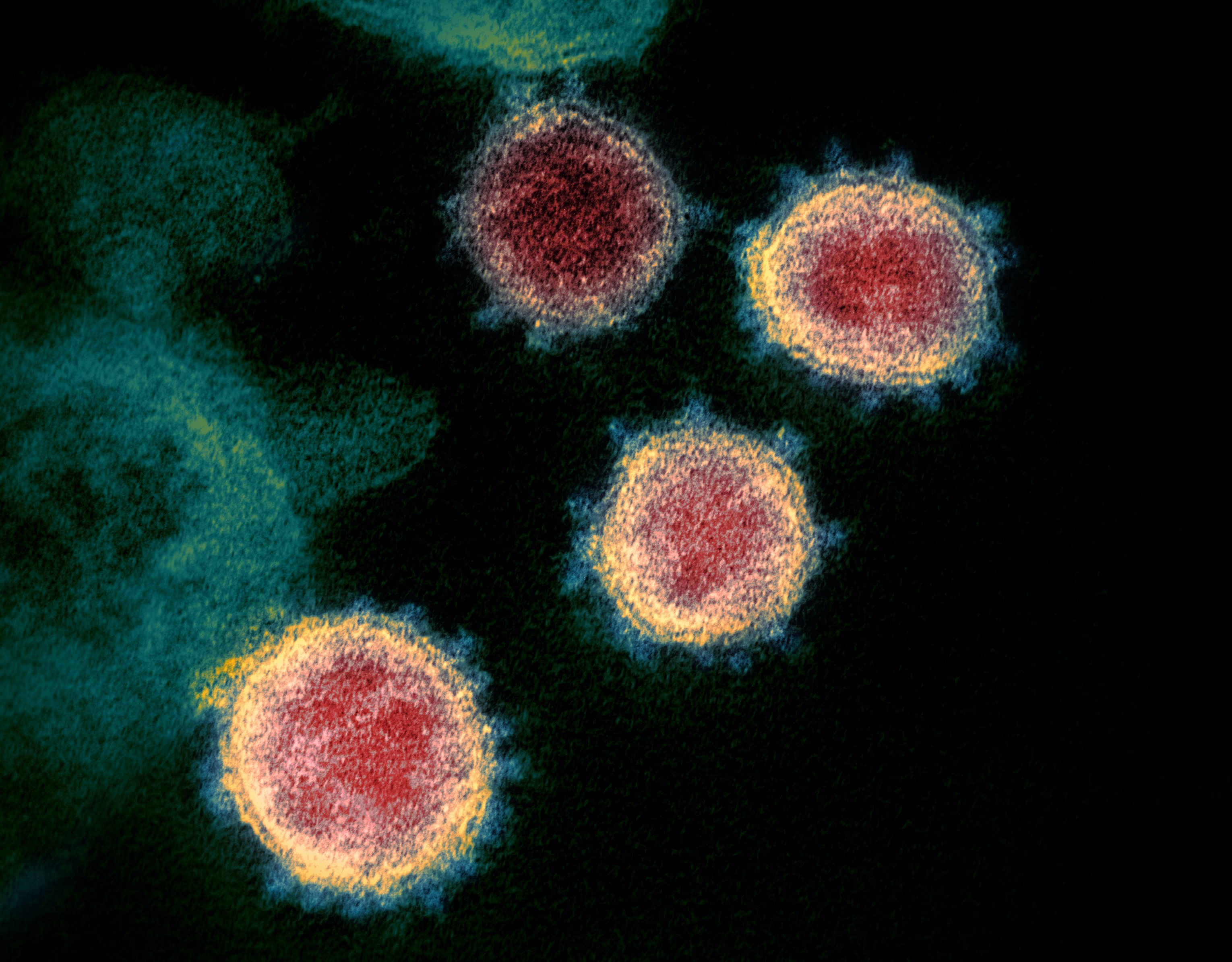 novel-coronavirus-sars-cov-2_49534865371_o.jpg