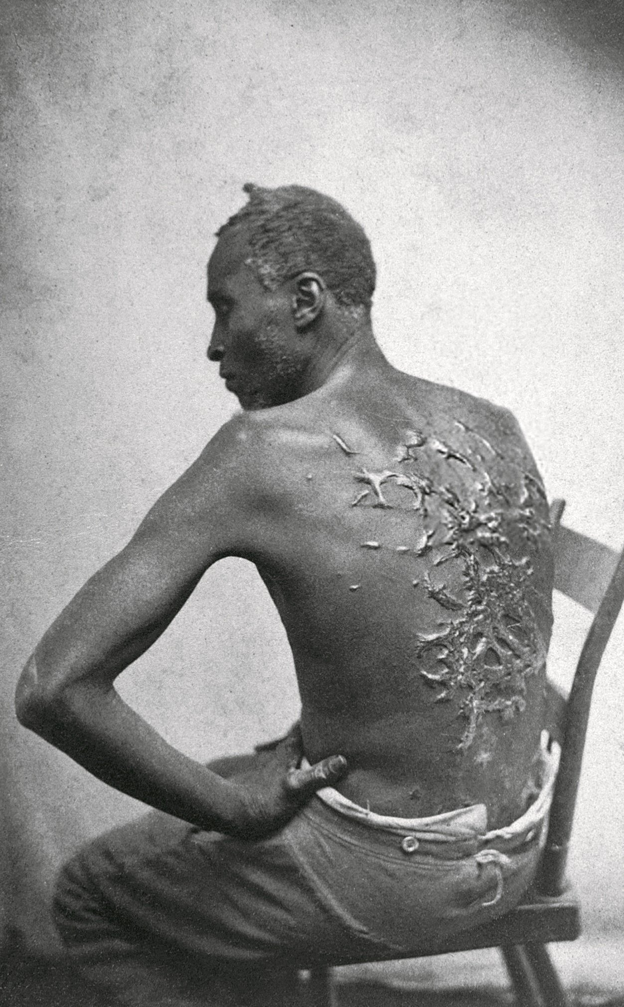 scourged_back_by_mcpherson_oliver_1863_retouched.jpg
