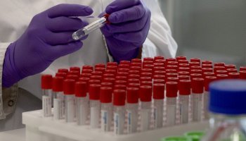 α mRNA εμβόλια κατά της Covid-19 δεν βλάπτουν το ανδρικό σπέρμα, δείχνει αμερικανική έρευνα